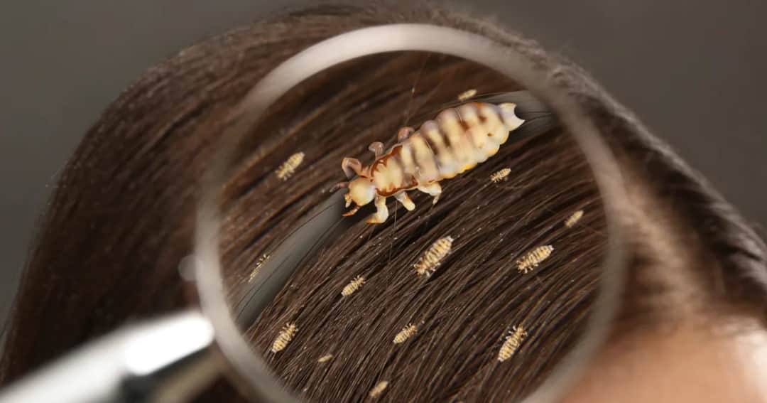 Czy dziecko z wszami może chodzić do przedszkola? Ważne informacje